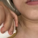 니드스킨 | 청주피부관리 니드스킨 팔관리후기