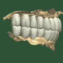 뉴치과기공소 이미지