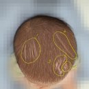 전파무기를 이용한 "머리카락,눈썹,수염 제모 기술" 이미지