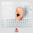 시그니아 독일보청기 하남센터 이미지