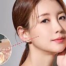 달러성형외과의원 이미지