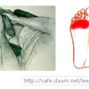 중족골 통증 이미지