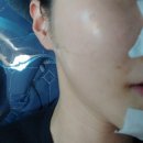인천 논현동 피부관리 효과좋은 스킨플래닝 나리뷰티
