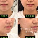 호야짐 | 대전 신부관리 추천으로 유명한 월평동 에스테틱 호야뷰티 내돈내산으로 다녀온 후기
