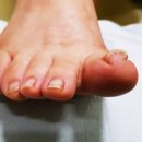 풋솔루션 이미지