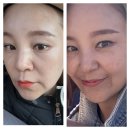 평택제일비뇨기과 및 피부과 방문후기