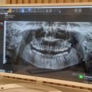 사랑니빠지는구강악안면외과치과의원 이미지