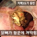 생선까시