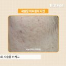 신사한의원 네이버블로그