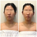 스킨케어(skin care) 가꿈, | 구미 목·어깨관리 잘하는 곳✨ 윤곽관리 효과까지 느낀 메리엘스킨케어 방문기
