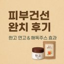 한방고등학교 | 피부건선연고 사용해서 치료성공한 후기