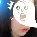 [김형진뉴라인성형외과] 입꼬리필러 후기 당일~1일차 후기 (사진많음주의)
