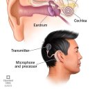 와우히어링 이미지