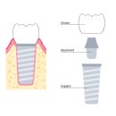 채움치과의원 이미지