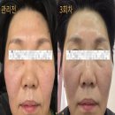 데모크레이지