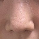 다루아쿠아 | 악센다 루티너 멀티밤 내돈내산 사용후기