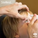 1001안경콘택트혁신도시점 | FDA승인완료‼️우리아이 눈건강 이제는 근시억제렌즈 스텔리스트를 믿고사용해보세요‼️1001안경전주만성점