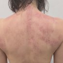 포항 라벨르뷰티 등관리 라운드숄더 마사지후기