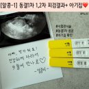 민산부인과의원 | [임신일기-1] 동결1차 1,2차 피검결과+ 아기집확인❤️