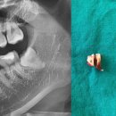 죽파치과 이미지