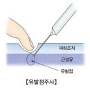 근육통에 좋은 약초. - 이미지