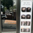 밀스칼프 이미지