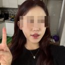 민해동물병원 | 강남논현동피부과 민클리닉 온다리프팅 후기 내돈내산