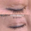 콜드 플라 송파 이미지