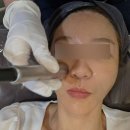 성모초교 | 강남피부과 추천 얼굴가려움 실비 가능한 "NDA플러스" 받고 왔어요