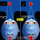 교통사고 후 눈이 돌아가는 외 사시와 상사시, 프리즘 안경 착용 후기, 눈매가 바르게 교정되었어요.
