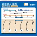 눈빛에안경 이미지