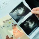 프라임상상유치원 | 육아휴직 임산부(임신부터 27주차)