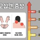 어깨통증 원인과 오십견 이미지