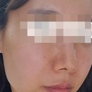 헤아림 래디언스 콜라겐 하이드로겔
