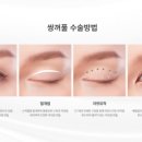 리엔장성형외과의원 네이버블로그