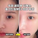 비비드림 | 성남 피부관리 유기농 진피케어로 속부터 광채, 올가드림뷰티 디톡스 후기