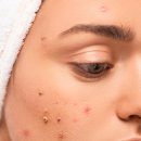 청담아이스피부과의원 이미지