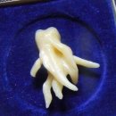 쏙쏙사랑니치과의원 이미지