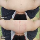 신도림 에스테틱 쥬아나스킨케어 맞춤관리 후기 (+예비신랑 승모근뿌시기)