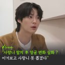 지민49 | "37살에 첫 사랑니 발치했더니 얼굴 변한 연예인" 발치 전후 극과극