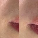 중동프라자 | 부천 중동 저자극 저통증 페이스 왁싱 후기, &#39;다올 드 왁싱 부천&#39;