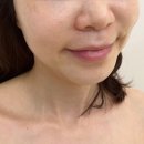청초한 스킨케어 | 원흥 피부관리 잘하는곳 추천 청초한스킨케어 재방문 후기