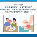 패혈증 원인 증상 진단 낫는법 예방 이미지