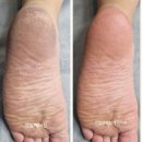 닥터아이티엔강남스킨케어 네이버블로그