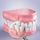 디아트치과의원 이미지