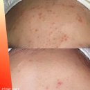 송도피부관리 에스떼리밋 이미지