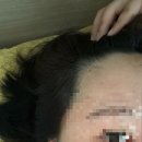 청주 두피관리, 청주 두피페인팅 미묘스튜디오 후기