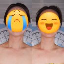 계동2 | 장유 턱선 정리 미선 에스테틱에서 JH유곽술 받고 온 리얼 찐 후기!!