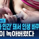 "뼈말라 인간'으로 인생 바뀌었는데..췌장염에 장기 괴사까지 / SBS / 모아보는 뉴스 이미지