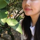 [부평역피부과/내돈내산] 브이메디스파_여드름 피부 관리 솔직후기와 자세한 전후 사진